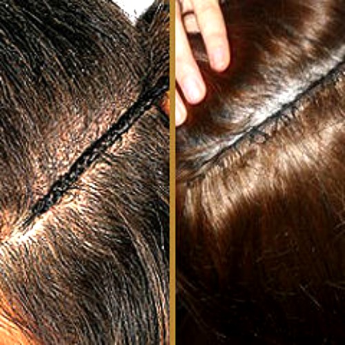 hair-and-method4 hair-and-method4